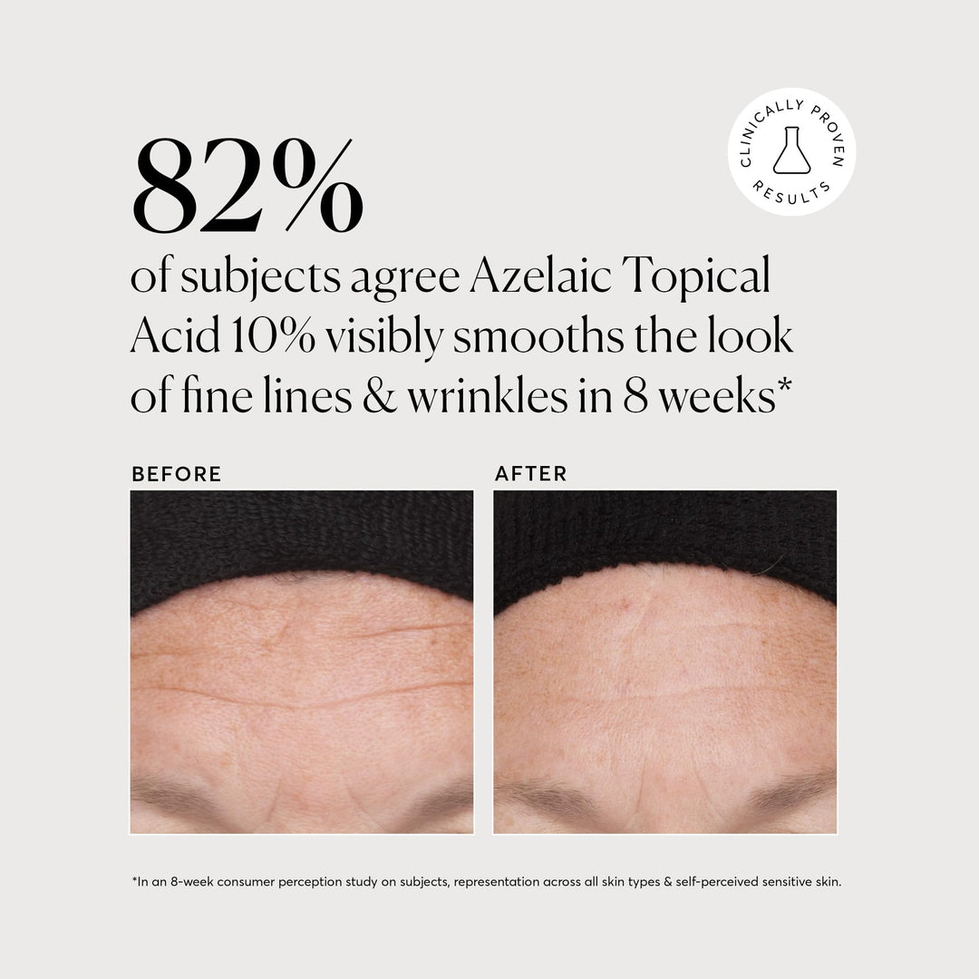 Naturium Azelaic Topical Acid 10%, Face & Skin Care Beauty Treatment with Niacinamide & Vitamin C, 1 oz