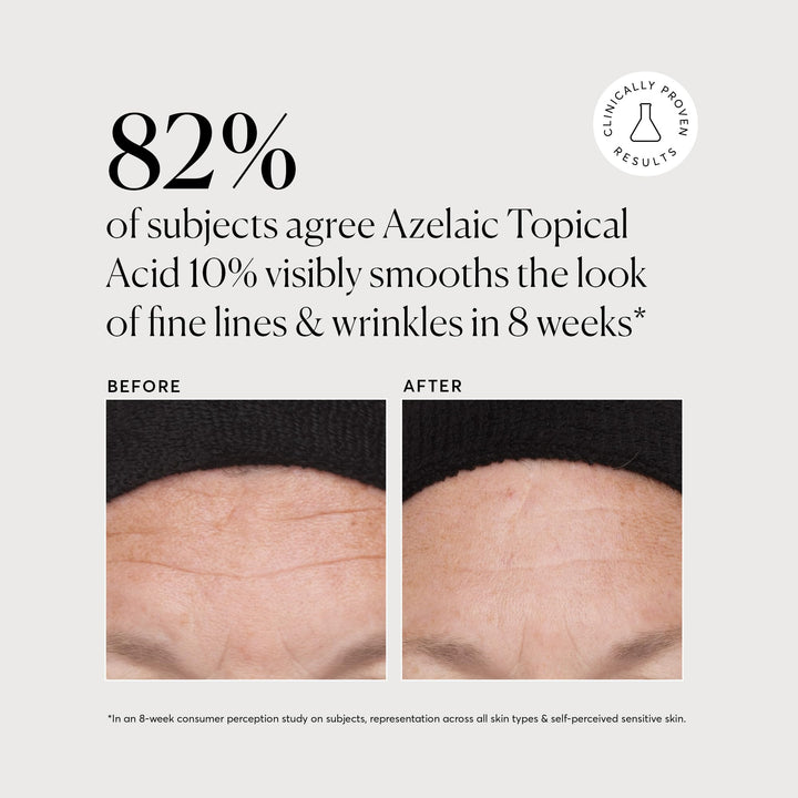Naturium Azelaic Topical Acid 10%, Face & Skin Care Beauty Treatment with Niacinamide & Vitamin C, 1 oz