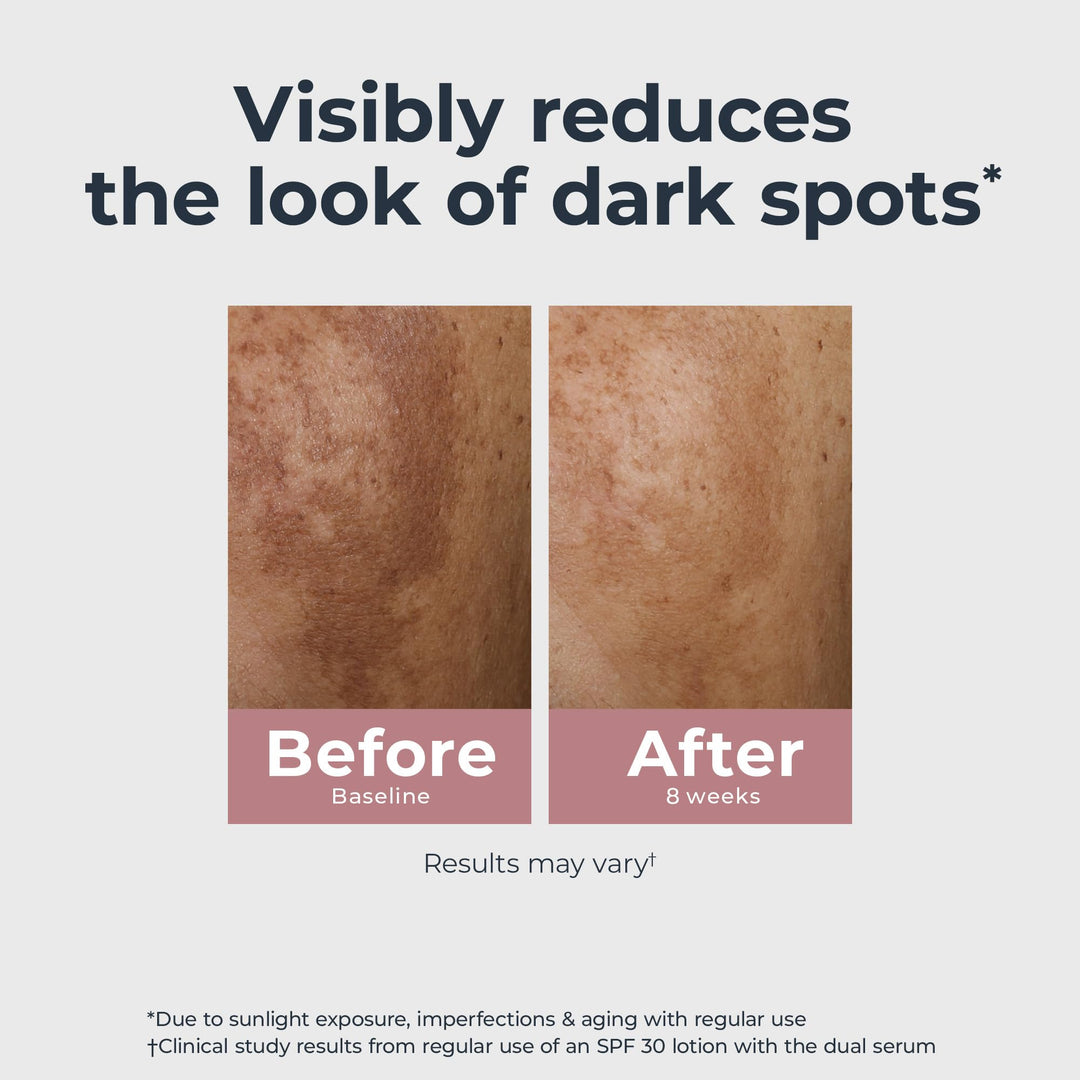 Eucerin Radiant Tone Dual Serum Dark Spot Corrector, Dark Spot Serum with Thiamidol and Hyaluronic Acid, Helps Visibly Reduce the Look of Persistent Dark Spots, 1 Fl Oz Bottle