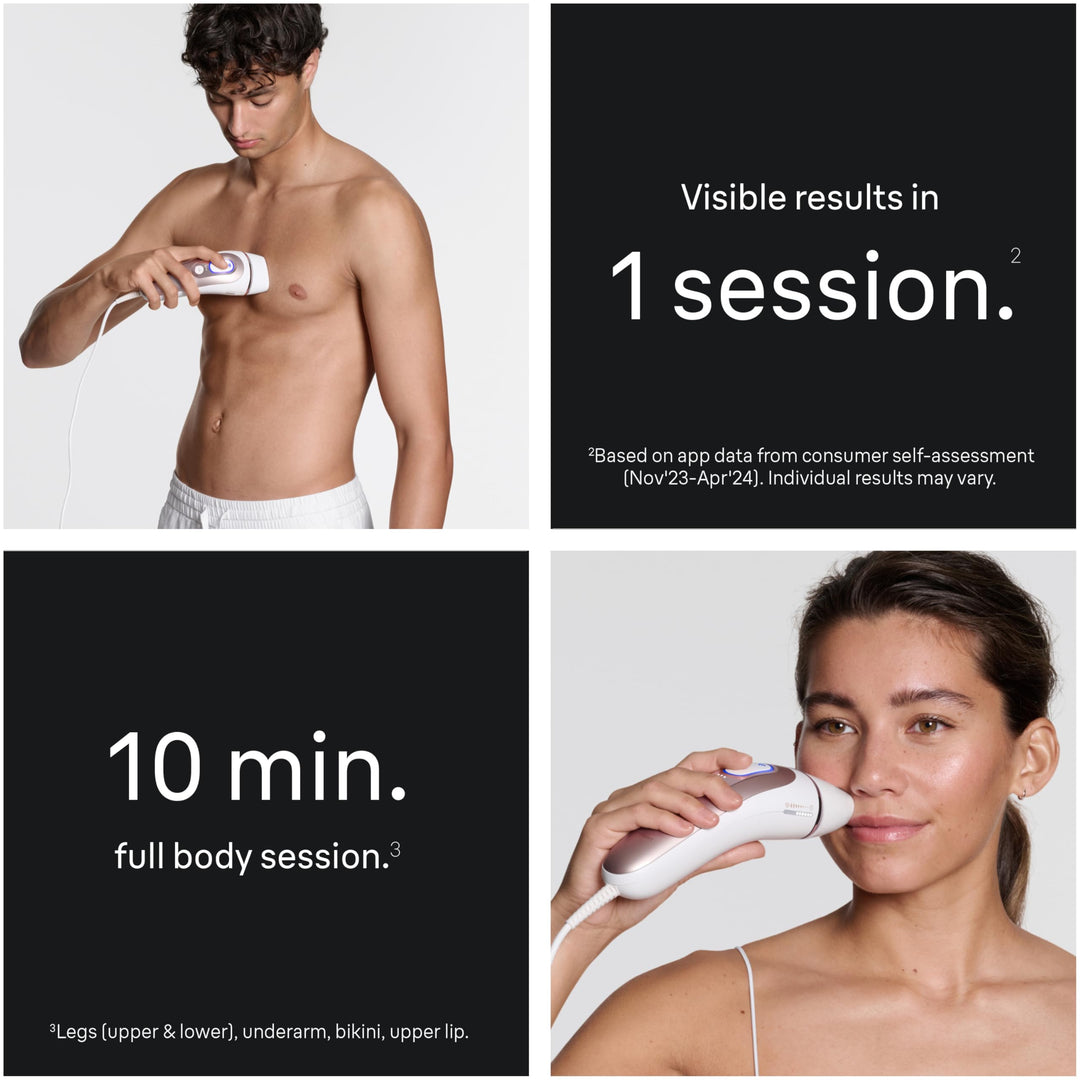 Braun Smart IPL, Skin i·Expert Pro 7: at Home Laser Hair Removal, Permanent Visible Hair Reduction, Vanity Case, Venus Razor, 3 Smart Heads, IPL7243 Retail $499.99