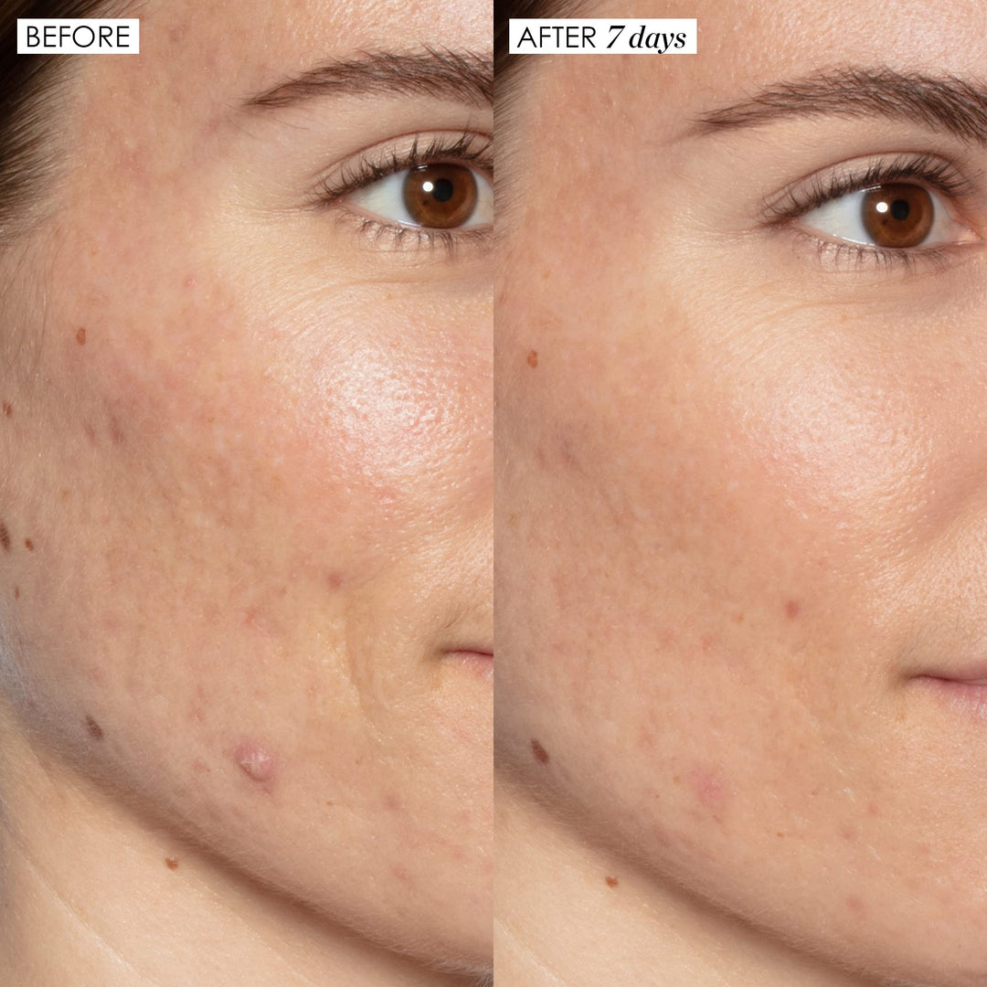 Sunday Riley Good Genes All-in-One Lactic Acid Treatment Face Serum