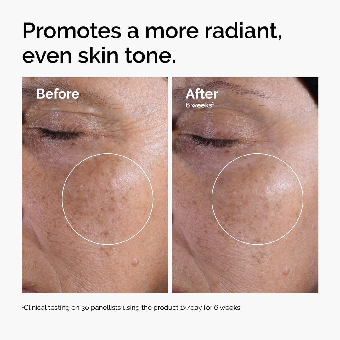 The Ordinary Glycolic Acid 7% Exfoliating Toner, Brightening and Smoothing Daily Toner for More Even-Looking Skin Tone, 8.1 Fl Oz