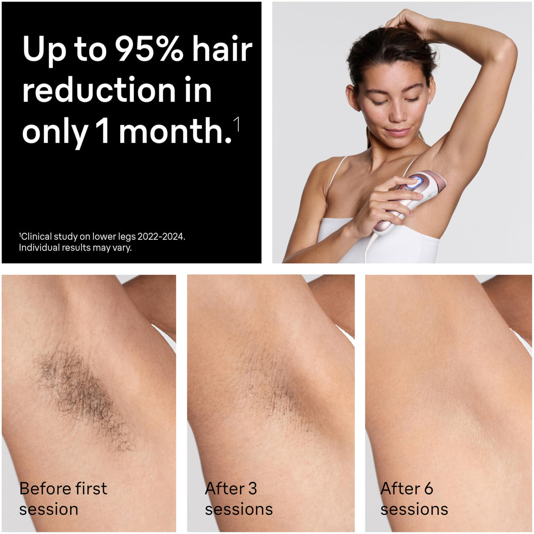 Braun Smart IPL, Skin i·Expert Pro 7: at Home Laser Hair Removal, Permanent Visible Hair Reduction, Vanity Case, Venus Razor, 3 Smart Heads, IPL7243 Retail $499.99
