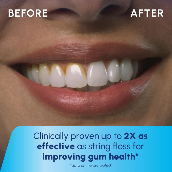 Waterpik Cordless Pulse Rechargeable Portable Water Flosser for Teeth, Gums, Braces Care and Travel with 2 Flossing Tips, Waterproof for Shower Use, ADA Accepted, WF-20 White, Packaging May Vary