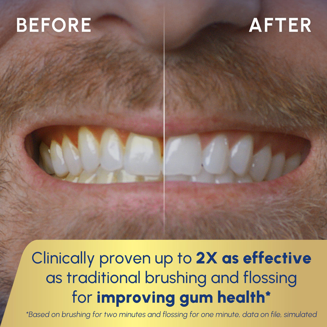 Waterpik Sonic-Fusion 2.0 Professional Flossing Electric Toothbrush with Water Flosser Combo In One, White SF-04, Packaging May Vary Retail $199.99