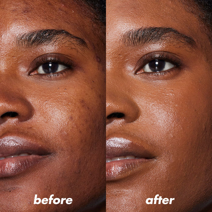e.l.f. Camo Color Corrector, Hydrating & Long-Lasting Color Corrector For Camouflaging Discoloration, Dullness & Redness, Vegan & Cruelty-Free, Orange