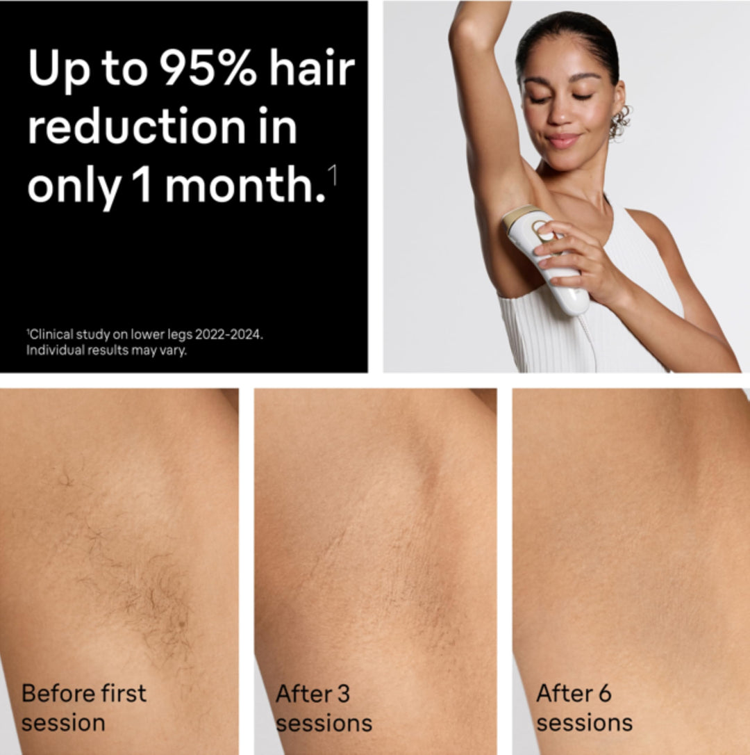 Braun IPL Silk·Expert Pro 5 PL5157 Latest Generation IPL, Permanent Visible Hair Reduction, at-Home Hair Removal System with Soft Pouch and Precision Head Retail $419.00